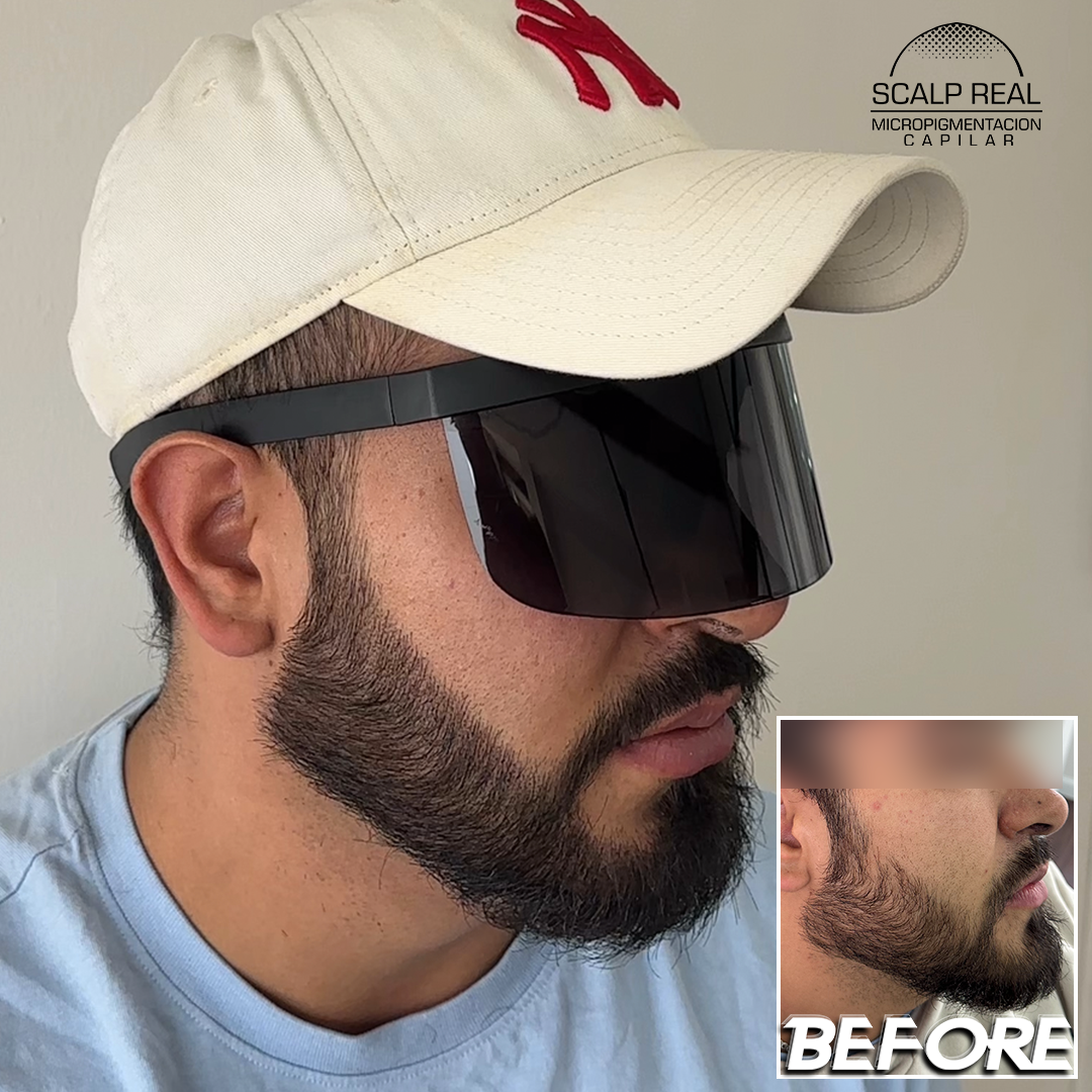 micropigmentacion en barba
