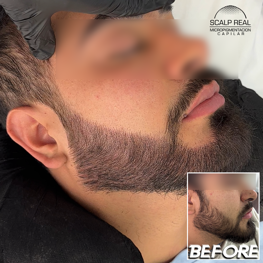 micropigmentacion en barba