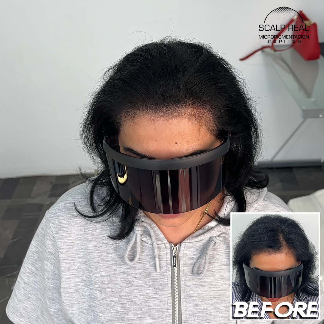 micropigmentacion capilar densidad mujer