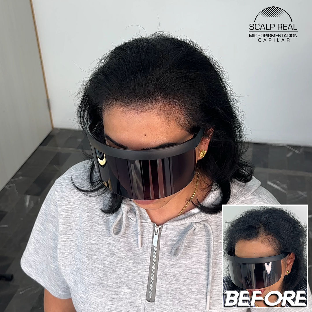 micropigmentacion capilar densidad mujer